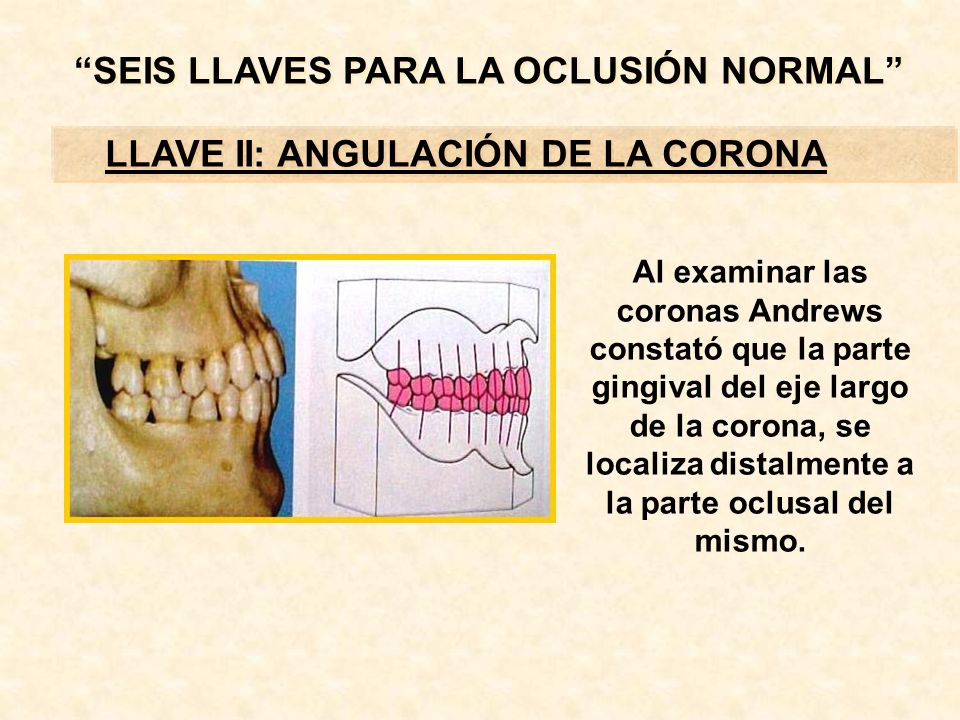 6 llaves de la oclusion andrews